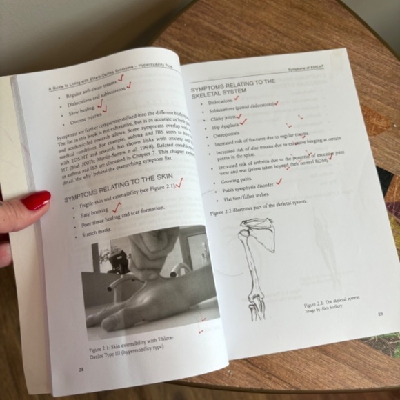 Living with Ehlers Danlos Syndrome (Hypermobility Type) Second Edition Used - Picture 4 of 4
